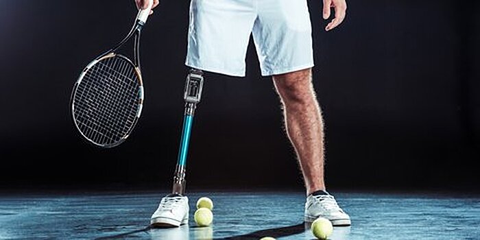 Бодипозитив. Если ты другой...