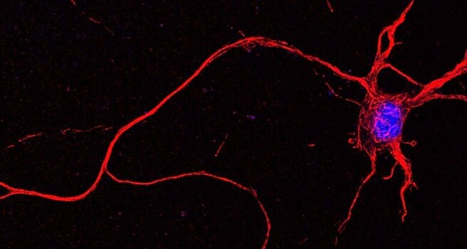 Ученые совместили живые и искусственные нейроны с помощью света