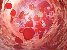 Врач предупредила о вреде народных методов чистки сосудов