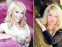 Трагические судьбы: женщины, чью жизнь сломали, облив кислотой