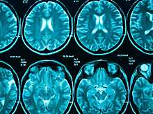 Ученые описали первый случай «невидимой» травматической энцефалопатии