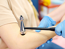 9 признаков того, что вам пора к неврологу