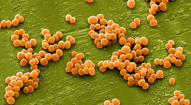 Как организм отличает вредные бактерии от безопасных?