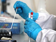 Централизованную лабораторию для тестов на коронавирус создадут в Чечне