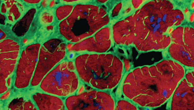 Из стволовых клеток впервые вырастили зрелую сердечную ткань
