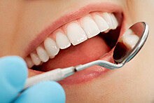 TimesNewsUK: отбеливающие пасты и разгрызание льда повреждают зубную эмаль