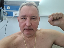 Рогозин выложил первое фото после ранения. Он заметно похудел