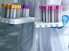 В России подтвердили 22 702 новых случая коронавируса