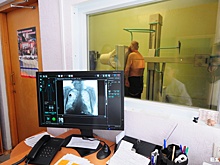 В Екатеринбурге снова можно будет бесплатно пройти флюорографию