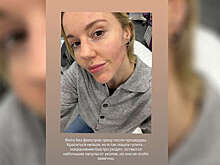 Ведущая Юлианна Караулова опубликовала фото без макияжа после уколов