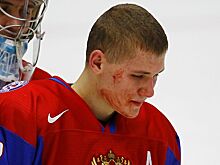 Сборная России подралась на молодежном ЧМ