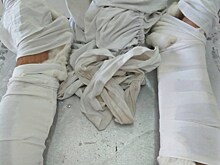 Во Вьетнаме житель Маркса попал в ДТП и сломал обе ноги