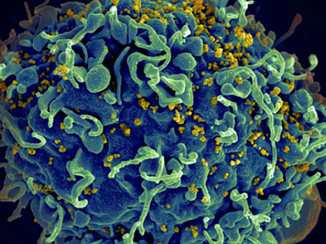 Мужчины в зоне риска: открыта связь между микробиомом пениса и заражением ВИЧ