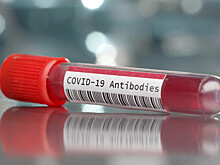 Эксперт рассказал, когда антитела к коронавирусу исчезают из организма