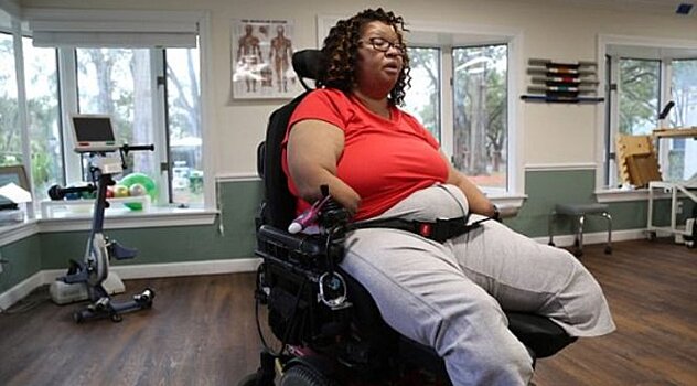 Из-за врачебной ошибки женщине отрезали руки и ноги