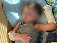 Мальчику оторвало часть пальца в одном из детских садов Нижнего Новгорода