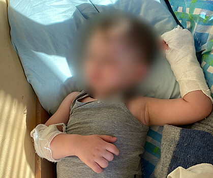 Мальчику оторвало часть пальца в одном из детских садов Нижнего Новгорода