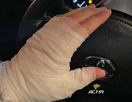 Новосибирец получил химические ожоги после поездки на электросамокате