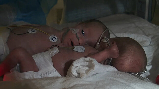 Папа снял трогательное видео о новорожденных близняшках – 5 млн просмотров