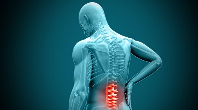 Частота операций при боли в спине в разных округах Германии различается в 13 раз