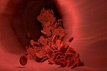 Врач-онколог Мяснянкин назвал первые признаки рака крови у детей