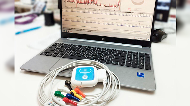 В Муравленковскую городскую больницу завезли новый холтер для мониторинга сердечного ритма