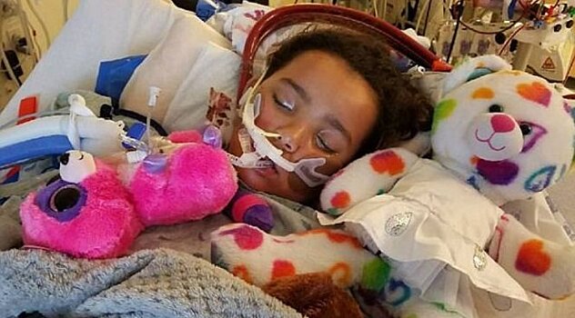 Из-за свиного гриппа у девочки отказали оба легких