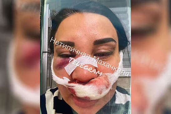 В Кизляре мужчина жестоко избил отвергшую его женщину
