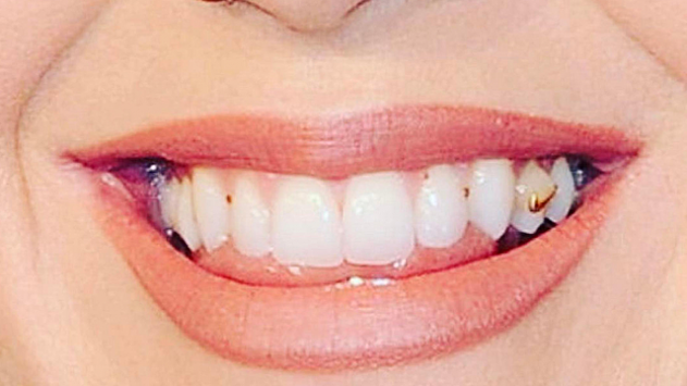 Ученые раскрыли самый простой способ отбеливания зубов