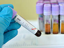 В России организации, утверждающие о «не существующем» ВИЧ, предложили приравнять к экстремистским