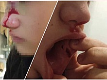 Дети мигрантов жестоко избили подростка во дворе школы под Новосибирском