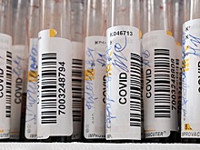 Эксперты "РГ" рассказали, когда можно надеяться на окончание COVID-19