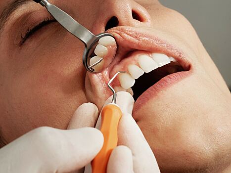 Врач-стоматолог: ранки во рту могут говорить о сахарном диабете