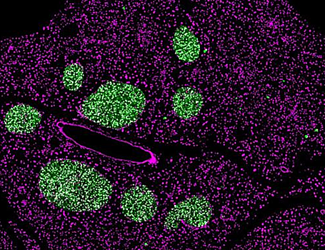 Как периодическое голодание влияет на развитие клеток у подростков