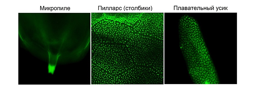 Амилоид оказался важен для правильного развития яйца плодовой мушки