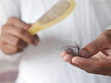 Доктор Мясников назвал лекарства, вызывающие выпадение волос