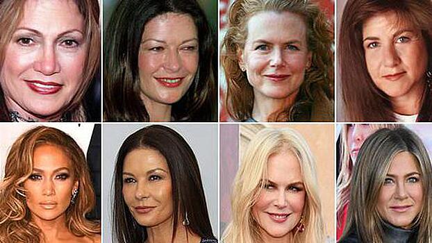 Разница налицо: хирург показала, как выглядели бы голливудские звезды в старости без пластики