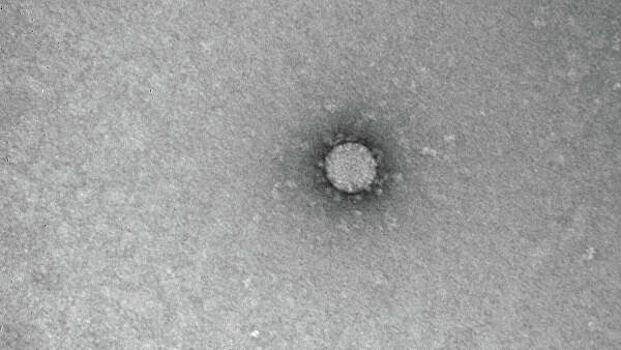 Академик объяснил слухи об искусственном происхождении коронавируса