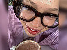 Рэперша Инстасамка показала несовершенства кожи