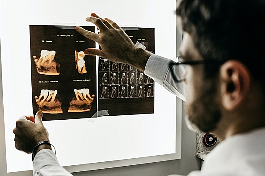 Компьютерная томография зубов: так ли она необходима