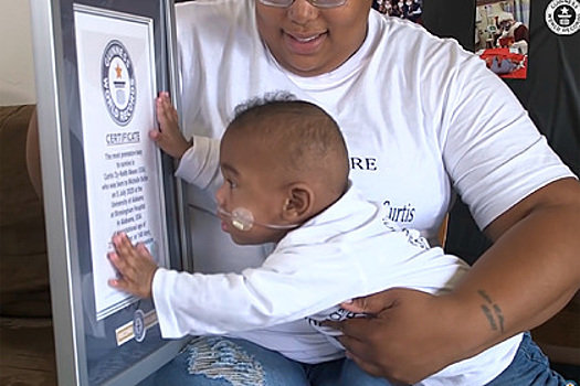 Самый недоношенный ребенок в мире выжил и установил рекорд