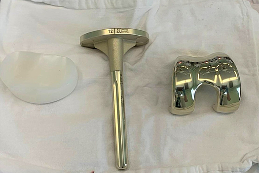 Медики ХМАО провели уникальную операцию по эндопротезированию