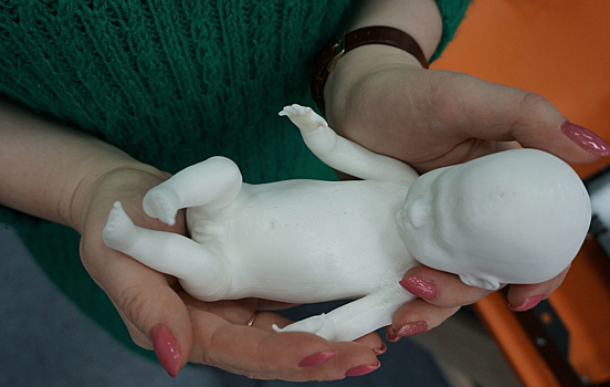 В Екатеринбурге на 3D-принтере напечатали первого настоящего ребенка