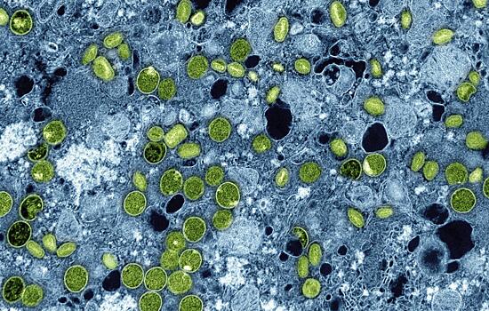 Вирус оспы обезьян вновь насторожил ученых