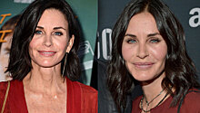5 актрис, которых пластические операции изменили до неузнаваемости. Как они выглядят сейчас