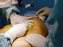 Украинские врачи калечили бойцов РФ, речь идет об операциях без наркоза