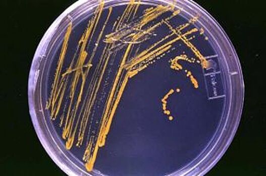 Специалисты рассказали о микроорганизмах, выживающих в разных условиях