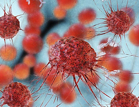 Найден новый способ ослабить раковые клетки