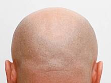 Российские школьники начали лысеть из-за стресса