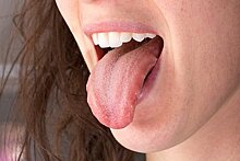 Российский врач рассказала о способе определить болезнь по цвету налета на языке